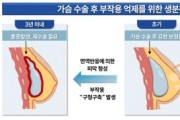 f_[사진3] 생분해성 고분자 섬유에 의한 오메가3의 방출과 구형구축 예방 효과 모식도.jpg