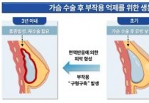 f_[사진3] 생분해성 고분자 섬유에 의한 오메가3의 방출과 구형구축 예방 효과 모식도.jpg