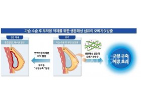 f_[사진3] 생분해성 고분자 섬유에 의한 오메가3의 방출과 구형구축 예방 효과 모식도.jpg
