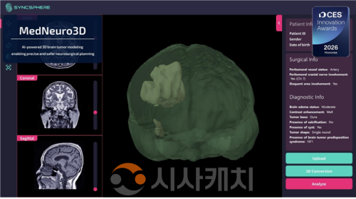 f_사진 1. ‘MedNeuro3D’ AI 기반3D 뇌 구조 모델링 후 최적 수술 경로 시뮬레이션 결과.png