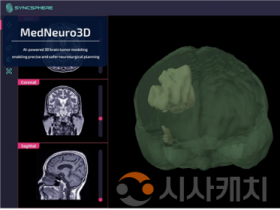 f_사진 1. ‘MedNeuro3D’ AI 기반3D 뇌 구조 모델링 후 최적 수술 경로 시뮬레이션 결과.png